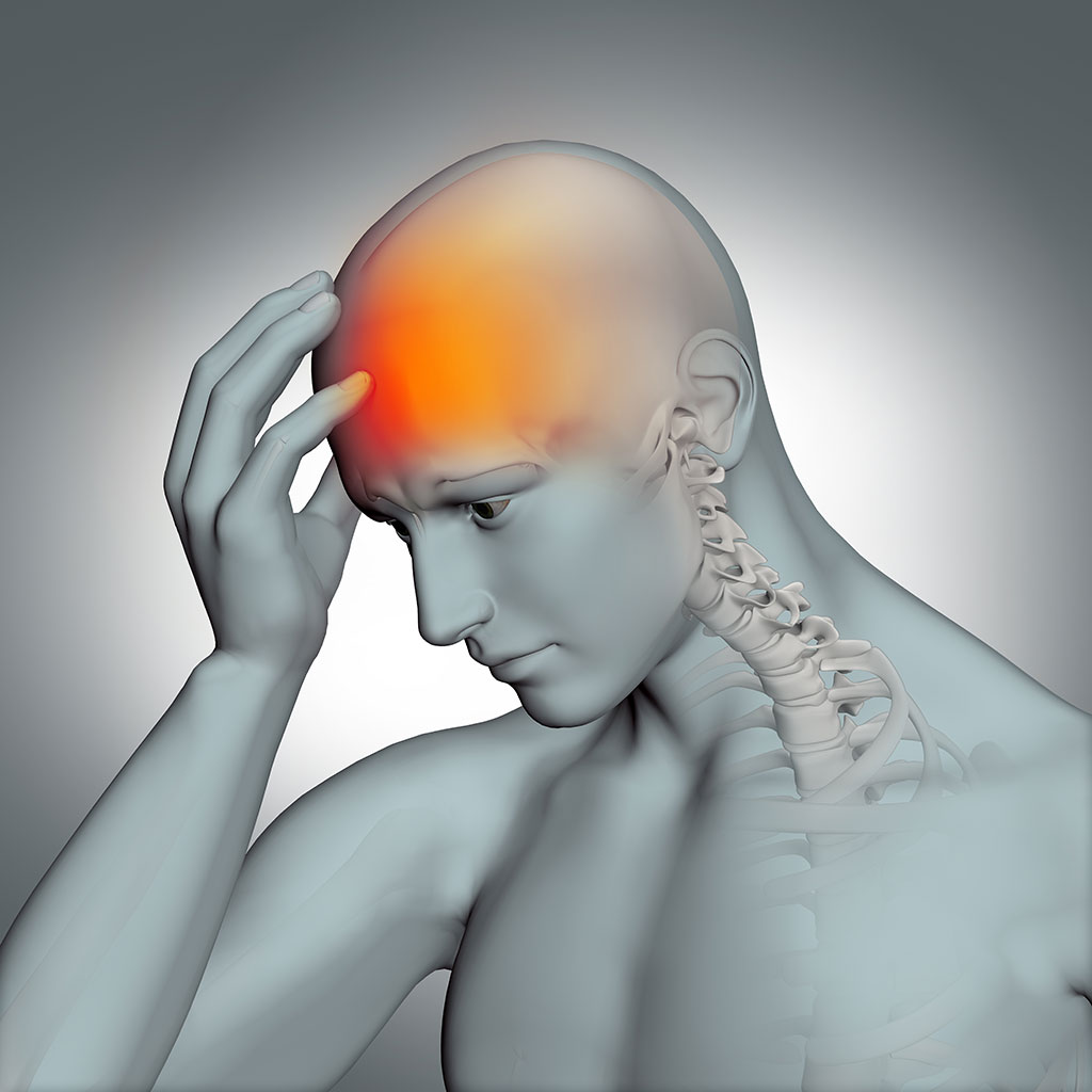 Cefalea muscolo tensiva (mal di testa)